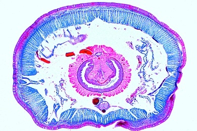 Mikropräparat - Lumbricus, Regenwurm, Körpermitte quer, Ringelwurm