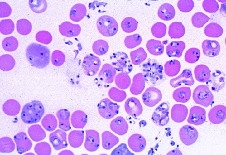 Mikropräparat - Plasmodium berghei, Malariaerreger,  Blutausstrich