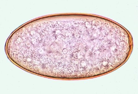 Mikropräparat - Fasciola hepatica, Großer Leberegel, Eier