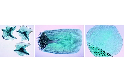 Mikropräparat - Fischschuppen-Typen: Cycloid-, Placoid-, Ctenoidschuppen