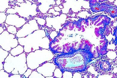 Mikropräparat - Lunge der Katze, quer, Bronchiolen, Alveolen
