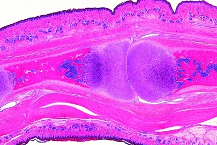 Mikropräparat - Knochenentwicklung, embryonaler Fingerknochen, längs
