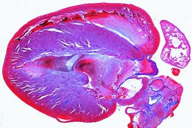 Mikropräparat - Herz der Maus, sagittal längs, Vor- und Hauptkammern