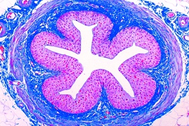 Mikropräparat - Harnleiter (Ureter) vom Kaninchen, quer