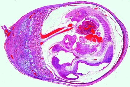 Mikropräparat - Uterus der Ratte mit Embryo, quer