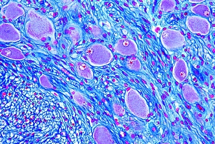 Mikropräparat - Sympathisches Ganglion, quer, Multipolare Nervenzellen