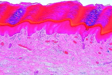 Mikropräparat - Unbehaarte Haut des Menschen, sagittal längs