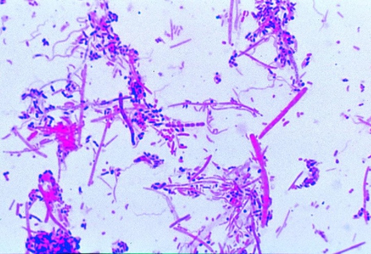 Mikropräparat - Bakterientypen: Kokken, Bazillen, Spirillen