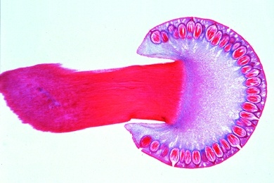Mikropräparat - Claviceps purpurea, Mutterkorn, Stroma mit Perithezien, längs
