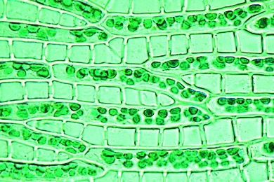 Mikropräparat - Sphagnum, Torfmoos, Blatt. Chlorophyll- und Wasserzellen