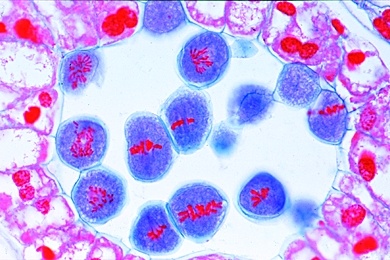 Mikropräparat - Lilium, Lilie, Staubbeutel quer, Pollenmutterzellen in Reduktionsteilung (Reifeteilungen)