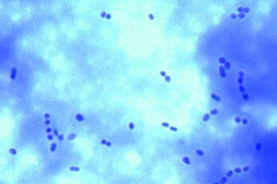Mikropräparat - Streptococcus lactis, Milchsäurebildner, Kurze Ketten
