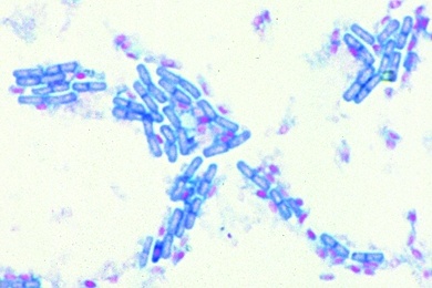Mikropräparat - Bacillus subtilis, Heubazillen, Ausstrich, Bazillen und Sporen