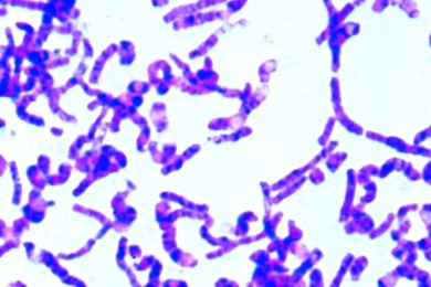 Mikropräparat - Bacillus mycoides, Wurzelbazillen, Färbung der Innenkörper
