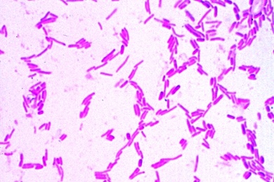 Mikropräparat - Salmonella paratyphi, Erreger des Paratyphus