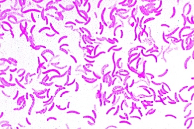 Mikropräparat - Rhodospirillum rubrum, farbstoffbildende Fäulnisbakterien