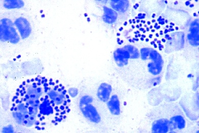 Mikropräparat - Neisseria gonorrhoeae (Gonokokken), Trippererreger