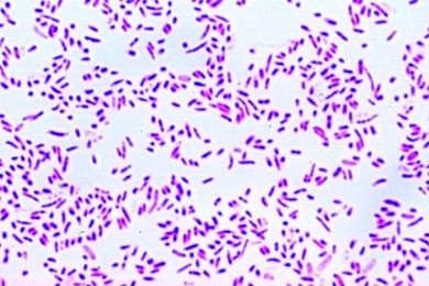 Mikropräparat - Pasteurella (Yersinia) pestis, Pesterreger, Ausstrich