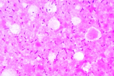 Mikropräparat - Bacterium erysipelatos, (Erysipelothrix rhusiopathiae) Rotlauferreger, Ausstrich
