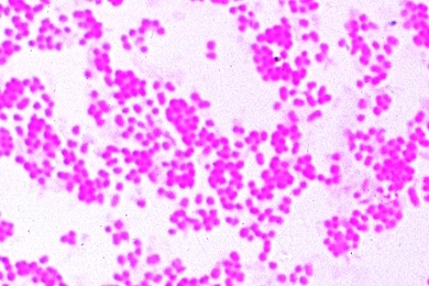 Mikropräparat - Bacterium prodigiosum (Serratia marcescens), rote Farbstoffbildner, Ausstrich von Kultur