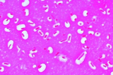 Mikropräparat - Klebsiella pneumoniae (Friedländer), Lungenentzündung. Färbung der Bakterienkapseln