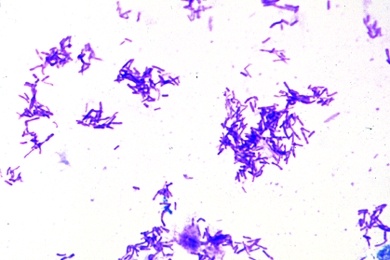 Mikropräparat - Proteus vulgaris, Fäulnisbakterien, Ausstrich