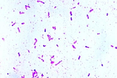 Mikropräparat - Rhizobium radicicola, stickstoffbindende Bakterien, Ausstrich