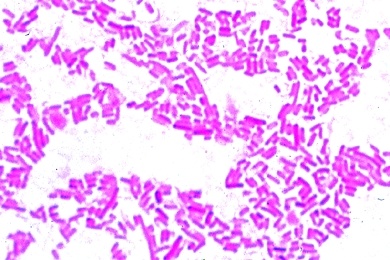 Mikropräparat - Salmonella enteritidis, Wurstvergiftung, Ausstrich