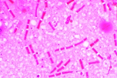 Mikropräparat - Bacillus anthracis, Milzbranderreger, Ausstrich von Kultur