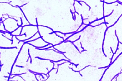 Mikropräparat - Streptomyces griseus, Antibioticum Streptomycin, Ausstrich