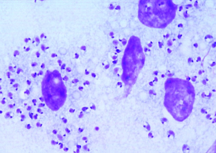 Mikropräparat - Leishmania donovani, Erreger der Kala-Azar