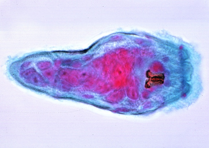 Mikropräparat - Fasciola hepatica in den Gallengängen der Leber, quer