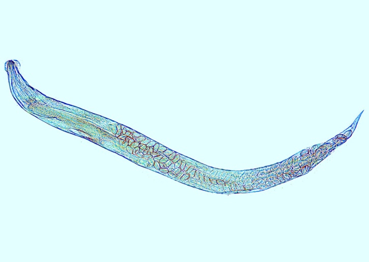 Mikropräparat - Enterobius vermicularis (Oxyuris), Madenwurm, Totalpräparat