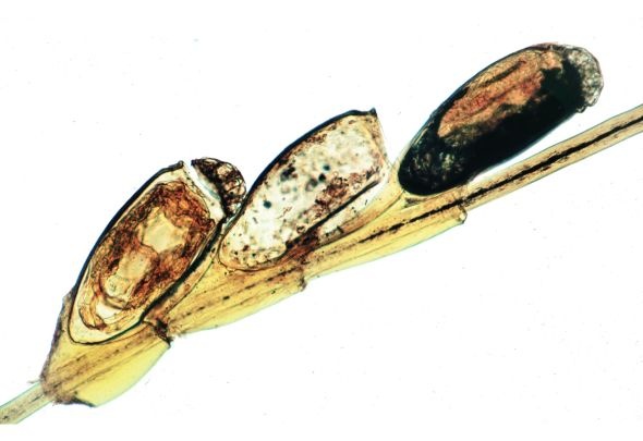 Mikropräparat - Pediculus humanus, Eier der Kopflaus am Haar (Nissen), Totalpräparat