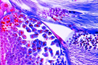 Mikropräparat - Heuschrecke, Hoden quer, Entwicklung der Spermatozoen