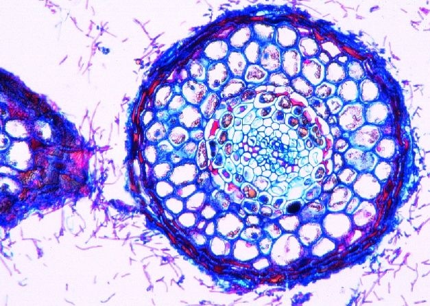 Mikropräparat - Wurzel der Buche mit ektotrophen Mykorrhiza, Querschnitt