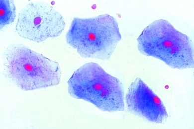 Mikropräparat Plattenepithel aus der Mundschleimhaut des Menschen, isolierte Zellen, Zellkerne und Zellplasma