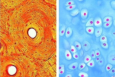 Mikropräparat - Knochen und Knorpel, quer. Knochenzellen und Lamellensysteme, Knorpelzellen und Grundsubstanz