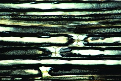 Mikropräparat - Nervenfasern, isoliert, Färbung mit Osmiumsäure zur Darstellung der Markscheiden, Ranvierschen Schnürringe