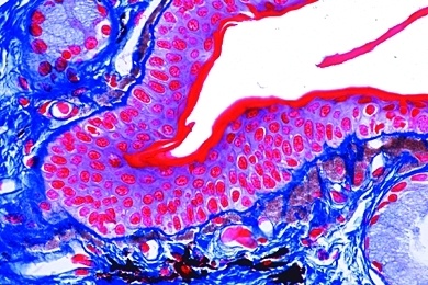 Mikropräparat - Haut und Organe einer Salamanderlarve, quer, Zellteilungen (Mitosen) in verschiedenen Stadien