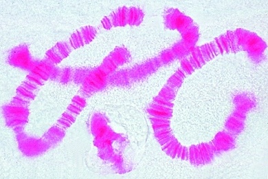 Mikropräparat - Speicheldrüse der Zuckmückenlarve (Chironomus)