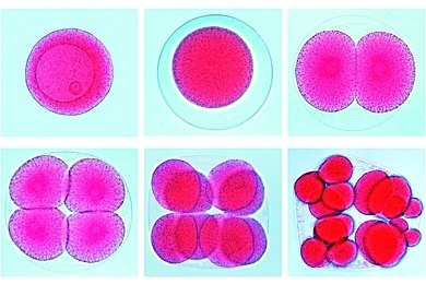 Mikropräparat - Eier vom Seeigel (Psammechinus). Unbefruchtete und befruchtete Eier, die ersten Furchungsstadien