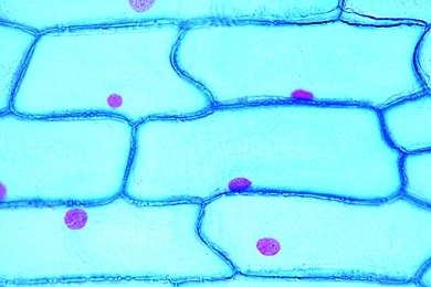 Mikropräparat - Epidermis der Küchenzwiebel (Allium cepa)