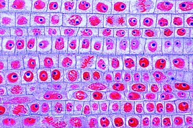 Mikropräparat - Wurzelspitze der Küchenzwiebel (Allium cepa), längs, Zellteilungen (Mitosen) in allen Stadien