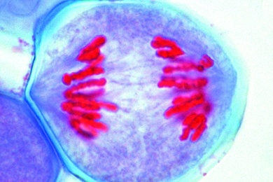 Mikropräparat - Pollenmutterzellen der Lilie. Metaphase und Anaphase der ersten Reifungsteilung, Ausbildung der Kernspindel