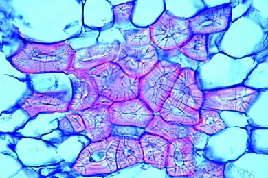 Mikropräparat - Fruchtfleisch der Birne (Pirus), quer, Steinzellen mit Tüpfelkanälen (Sklerenchymzellen)