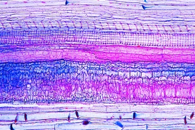 Mikropräparat - Kürbis (Cucurbita) Stamm längs. Gefäßbündel mit Siebröhren, Ring und Netzgefäßen, Sklerenchymfasern