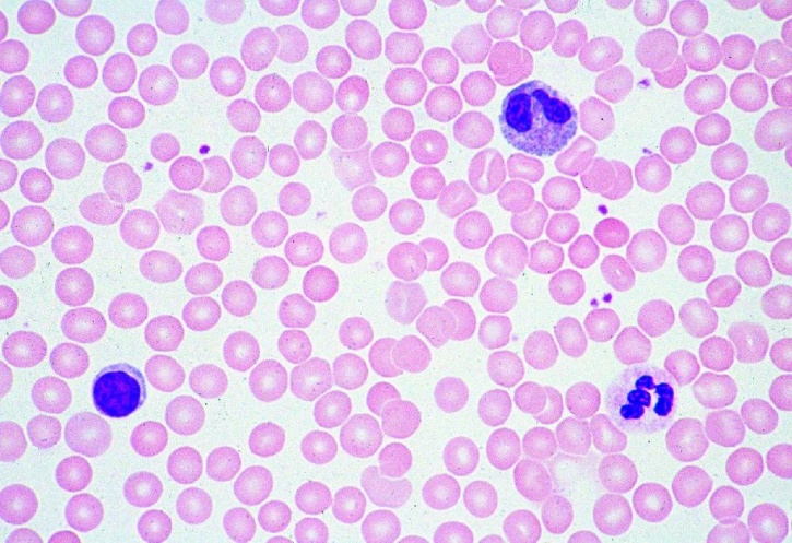 Mikropräparat - Blut vom Menschen, Ausstrich, Rote und weiße Blutkörperchen, Färbung nach Giemsa