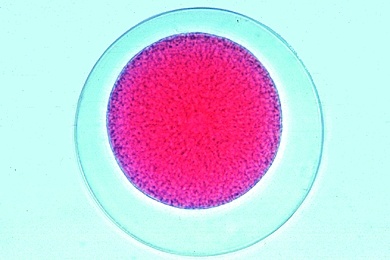 Mikropräparat - Seeigel, befruchtete Eier