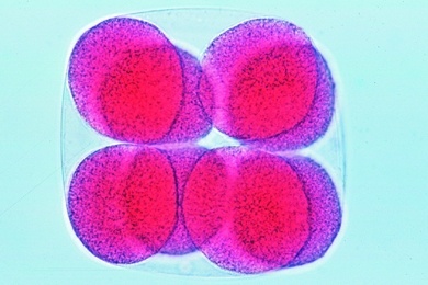 Mikropräparat - Seeigel, Acht-Zellen-Stadium
